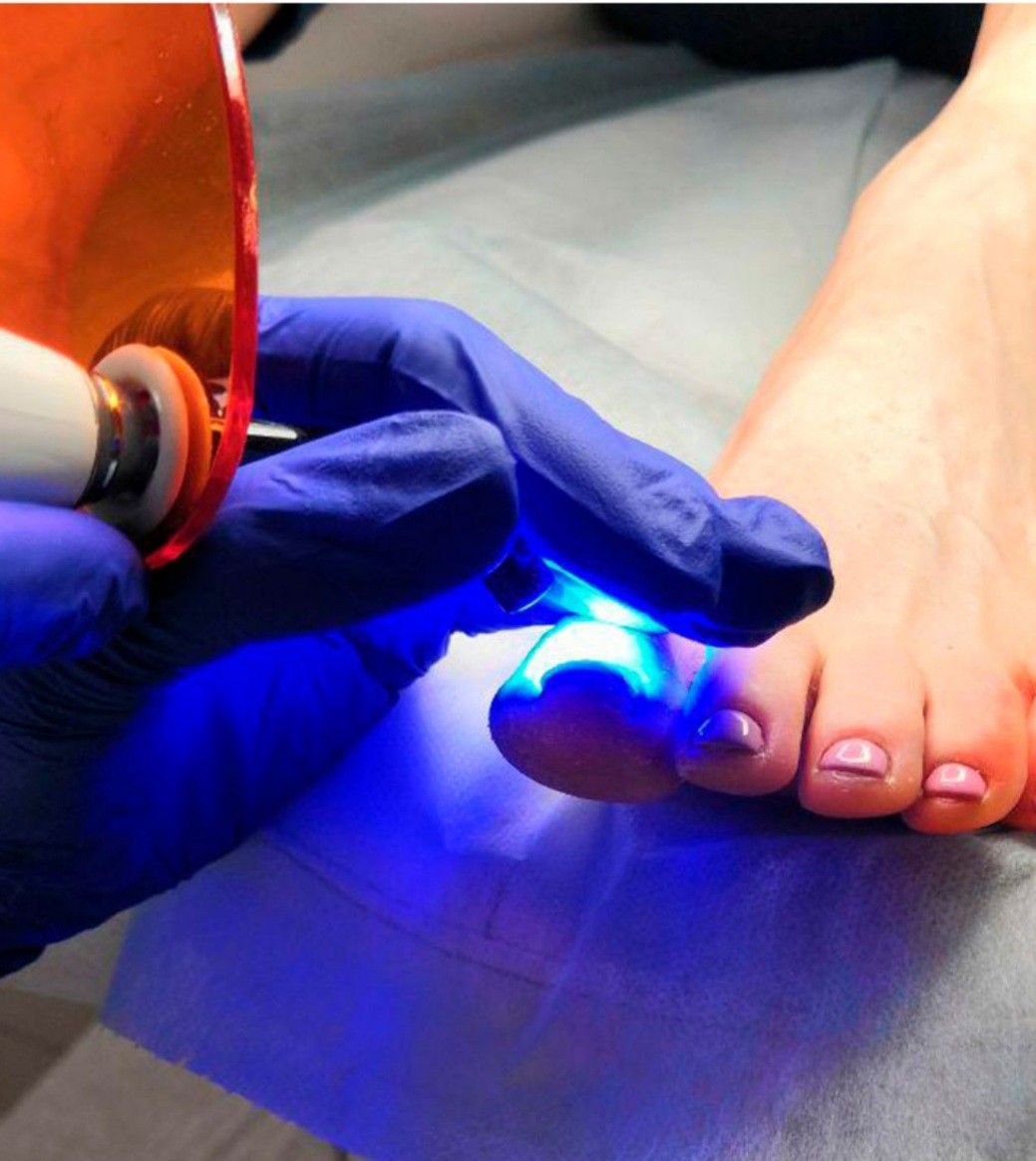 Pedicure Clínico en Bogotá - Pie Pro Salud Kennedy Central