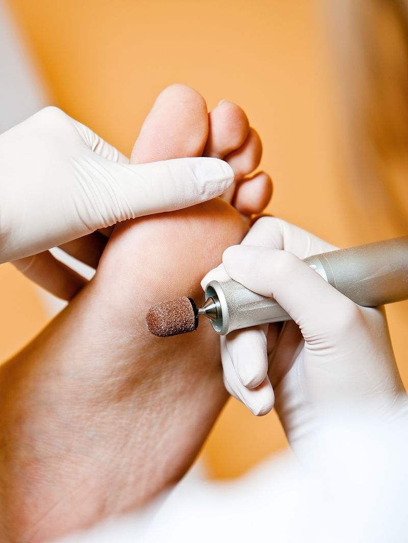 Tratamiento Pie Diabético en Bogotá - Pie Pro Salud Kennedy